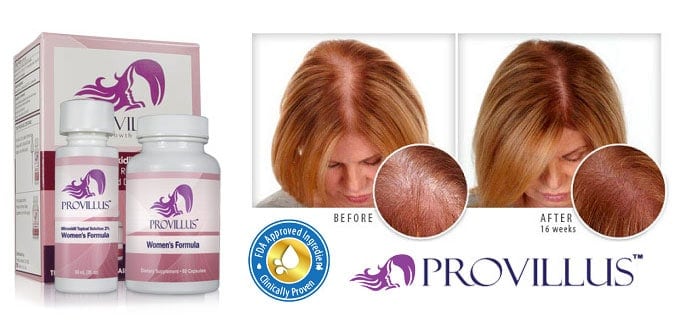 Provillus for Women Review