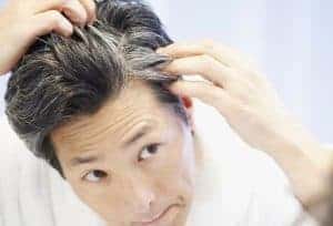 Premature Grey Hair Treatment