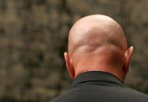 Shiny Bald Head